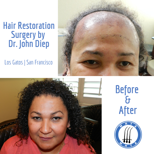 Hair Replacement Service «Medical Hair Transplants & Aesthetics», reviews and photos, 15055 Los Gatos Blvd Suite #110, Los Gatos, CA 95032, USA