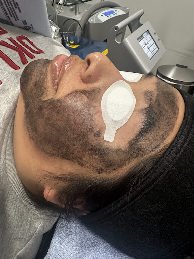 Explore chef tattoo ideas, creative tattoo ideas in Mckinney, available at Premier Tattoo Removal