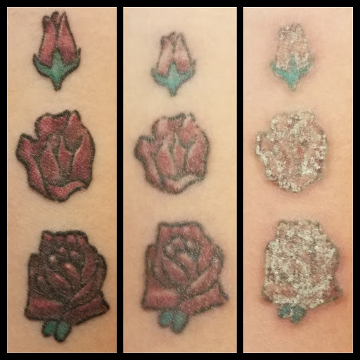Explore rip mom tattoo ideas, creative tattoo ideas in Dubuque, available at Retrospect Tattoo Removal