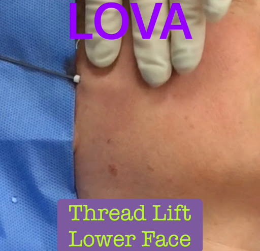 Explore yankee tattoo ideas, creative tattoo ideas in Lake Oswego, available at Lake Oswego Vein and Aesthetic LOVA