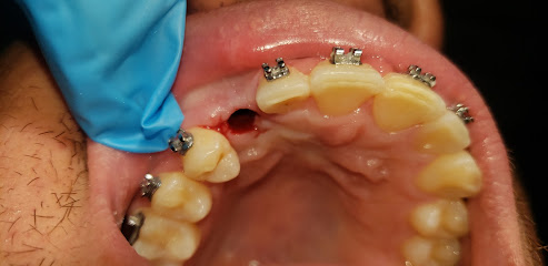 Clinica De Especialidades Odontologícas 'Dental Implant'