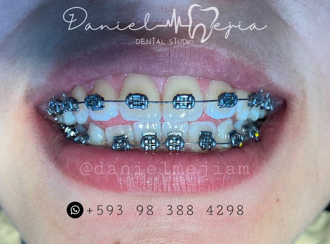 Daniel Mejia DENTAL STUDIO - Dentista