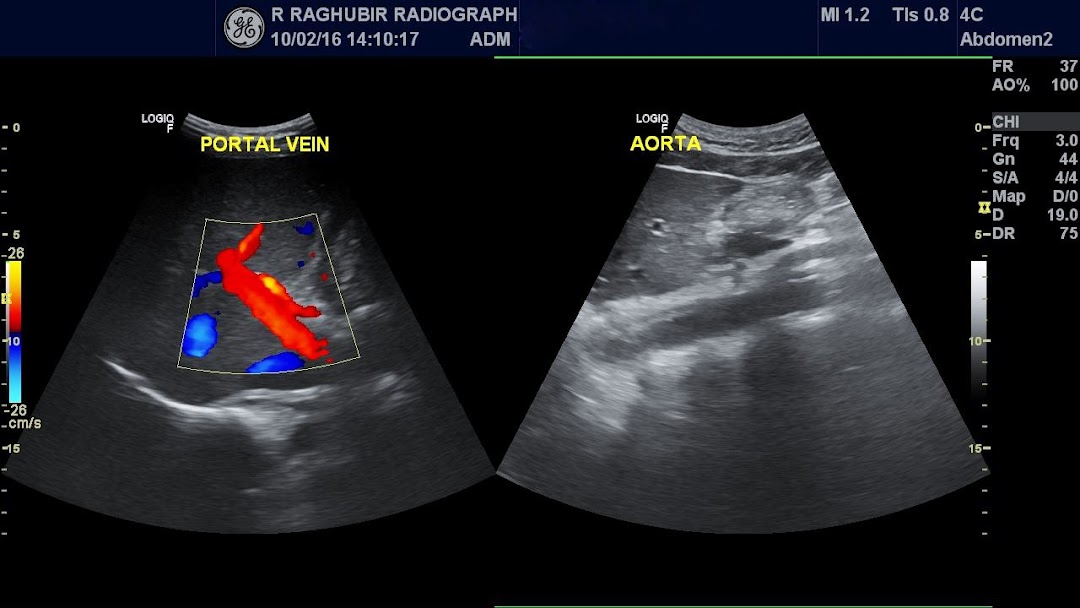 R RAGHUBIR RADIOGRAPHY (X-RAY - ULTRASOUND - BONE DENSITY - BODY COMPOSITION)