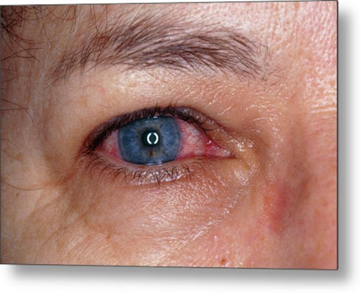 Optometrist «Park Family Eye Care», reviews and photos, 9 S Lincolnway St, North Aurora, IL 60542, USA