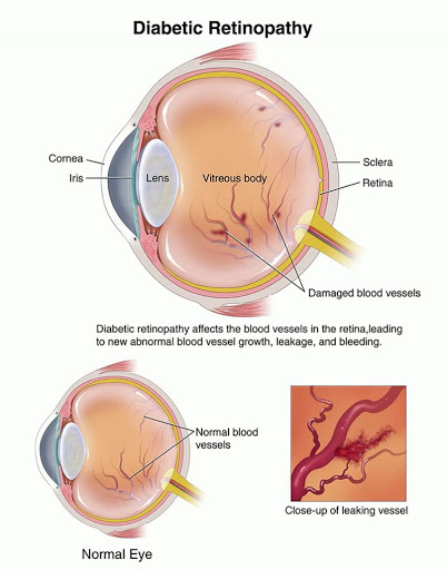 Eye Care Center «Wolfe Eye Clinic», reviews and photos, 1245 2nd Ave SE, Cedar Rapids, IA 52403, USA