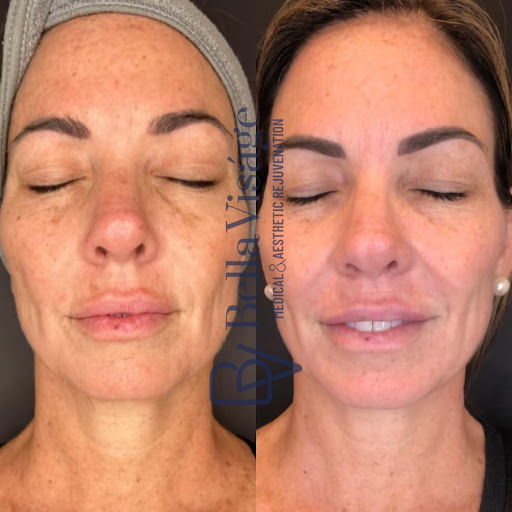 Explore cat tattoo ideas for guys, creative tattoo ideas in Lakeland, available at Bella Visge Medical & Aesthetic Rejuvenation