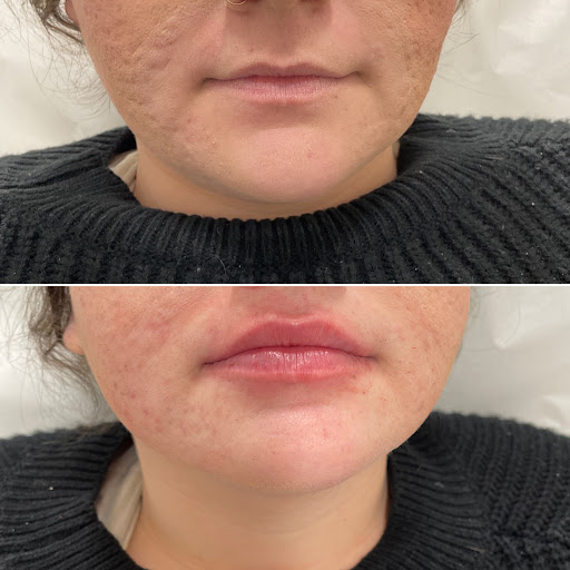 Explore kobe tattoos ideas, creative tattoo ideas in Owensboro, available at The Skin Lab