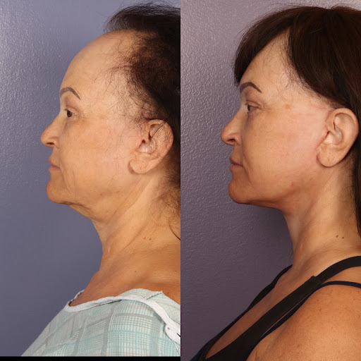 Dr. Gould Plastic Surgery image