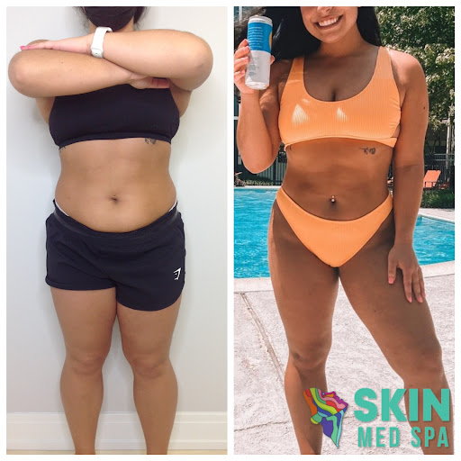 Explore tom petty tattoo ideas, creative tattoo ideas in Downers Grove, available at Skin Med Spa