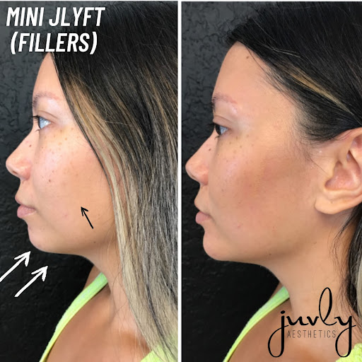 Medical Spa «Contour Clinic | Vadnais Heights», reviews and photos, 1058 Centerville Cir, Vadnais Heights, MN 55127, USA