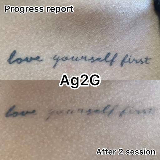 Explore flower bouquet tattoo ideas, creative tattoo ideas in New York, available at Ag2g Laser Tattoo Removal & MedSpa