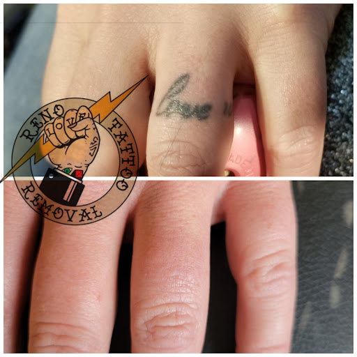 Explore black and grey tattoo ideas, creative tattoo ideas in Reno, available at Reno Tattoo Removal