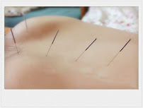 Medical Acupuncture - Photo 9 - Car repair in Orange City, FL, Orlando