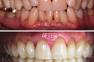Riviera Smiles - Santa Barbara Dentist - Dr. Ana Martinez image