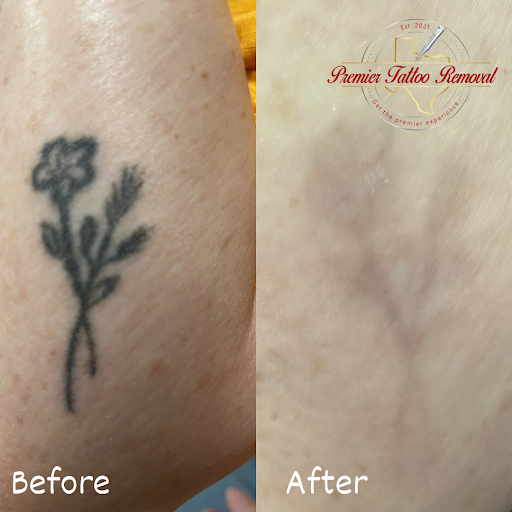 Explore tattoo ideas for brothers, creative tattoo ideas in Mckinney, available at Premier Tattoo Removal