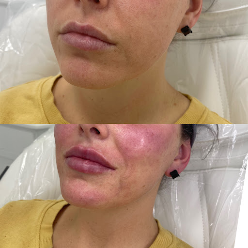 Explore anakin skywalker tattoo ideas, creative tattoo ideas in Owensboro, available at The Skin Lab