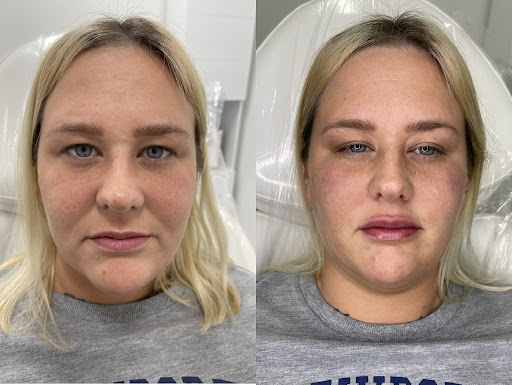 Explore inside lip tattoo ideas, creative tattoo ideas in Owensboro, available at The Skin Lab