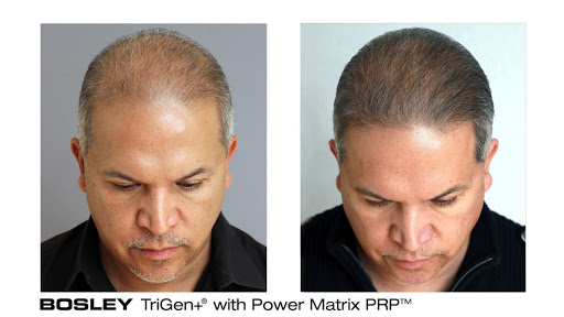 Hair Transplantation Clinic «Bosley Medical - Atlanta», reviews and photos, 3379 Peachtree Rd NE #800, Atlanta, GA 30326, USA