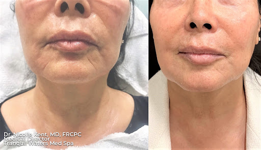 Medical Spa «Tranquil Waters Med Spa», reviews and photos, 6510 S Higley Rd #102, Gilbert, AZ 85298, USA