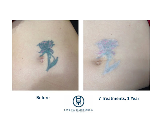 Explore daughter father tattoo ideas, creative tattoo ideas in San Diego, available at Removery Tattoo Removal & Fading