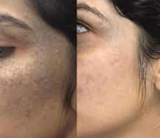 Explore couple ring finger tattoo ideas, creative tattoo ideas in Mountain Home, available at Skin Perfections Studio