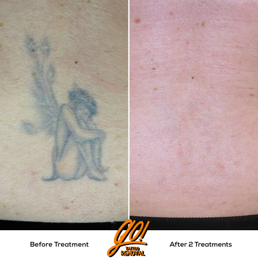 Explore cyber sigilism tattoo ideas, creative tattoo ideas in Allentown, available at Removery Tattoo Removal & Fading