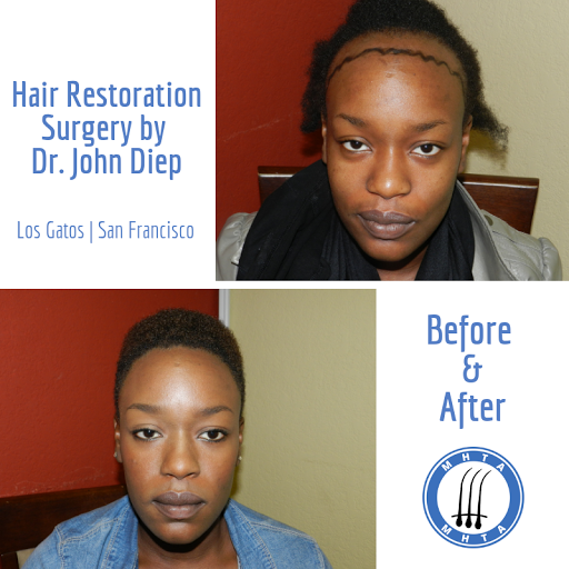 Hair Replacement Service «Medical Hair Transplants & Aesthetics», reviews and photos, 15055 Los Gatos Blvd Suite #110, Los Gatos, CA 95032, USA