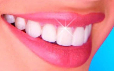Dr. Aishwarya More (OM Dental & Aesthetics, Satara) image