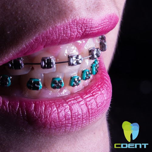 Clinica Dental CDENT - Dentista