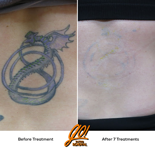 Explore dreamcatcher tattoo ideas, creative tattoo ideas in Allentown, available at Removery Tattoo Removal & Fading