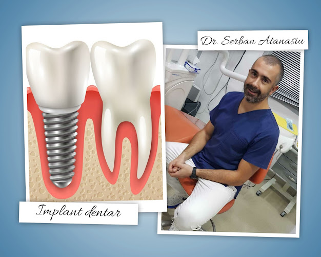 Dr. Toea Carmen Mihaela - Partener Miko Dental - Implant dentar Focsani - <nil>