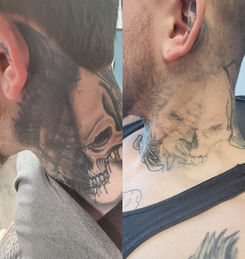 Explore chinese character tattoo ideas, creative tattoo ideas in Rochester, available at Rochester Tattoo Removal