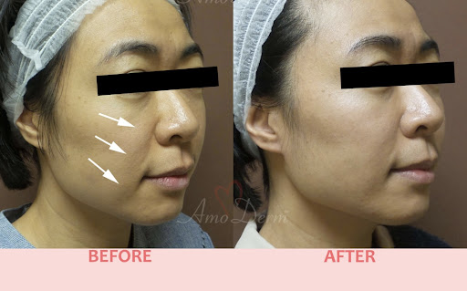 Medical Spa «Lavender Med Spa», reviews and photos, 3675 Crestwood Pkwy #400, Duluth, GA 30096, USA