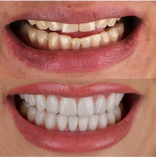 Af1qipnwuzfyryz Zaw7qrvsxpawlife6jw7febfbjcw