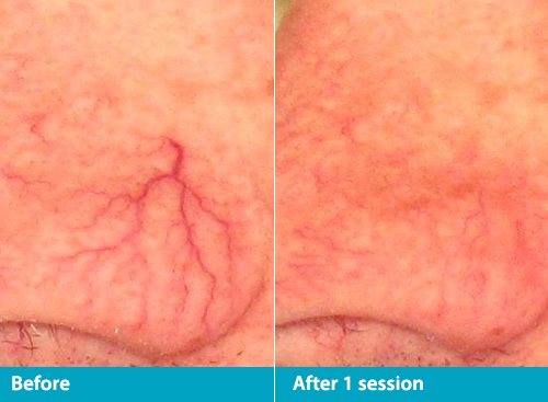 Beach Cities Vein and Laser Center image