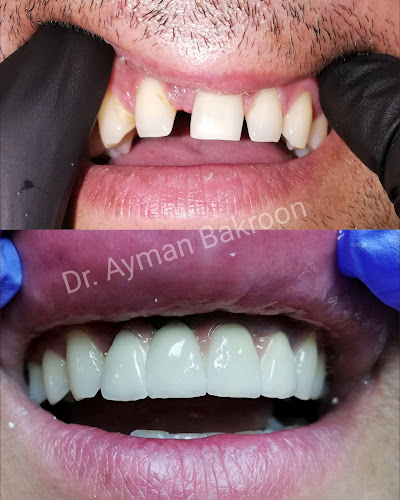 Dr.Bakroon Ayman - Dentist