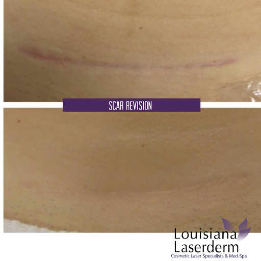 Explore daddy dom tattoo ideas, creative tattoo ideas in Baton Rouge, available at Louisiana Laserderm