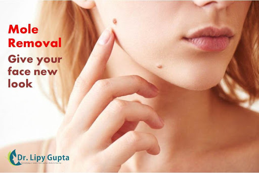 Dr. Lipy Gupta Dermatology Clinic, Dermatologist in Delhi, Skin Specialist in Delhi, Hair & Skin Expert
