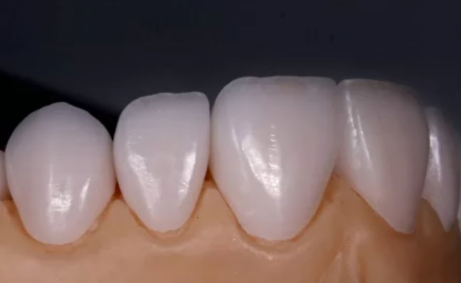 Dr.Anita Iorgu - Stomatolog Craiova, Ortodont Craiova, Aparat Dentar Craiova, Albire Dentara, Fatete Dentare. Dentist Bun Craiova - Dentist