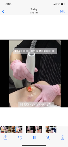 Explore space tattoos ideas, creative tattoo ideas in Lake Oswego, available at Lake Oswego Vein and Aesthetic LOVA