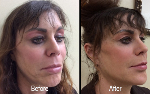 Explore coastal tattoo ideas, creative tattoo ideas in Sterling Heights, available at Skin & Vein Center