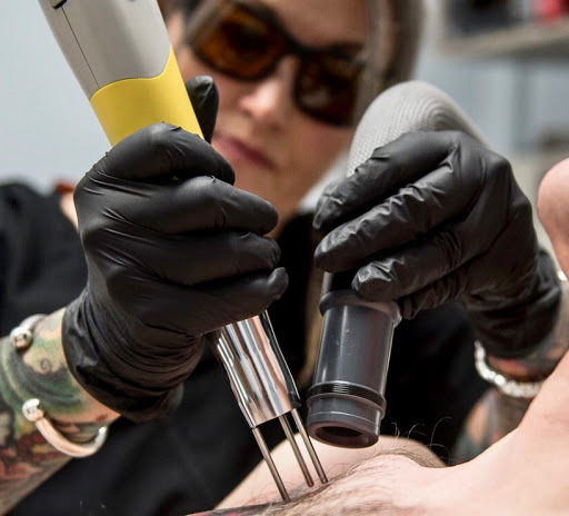 Explore juice wrld tribute tattoo ideas, creative tattoo ideas in East Lansing, available at Lansing Laser Tattoo Removal