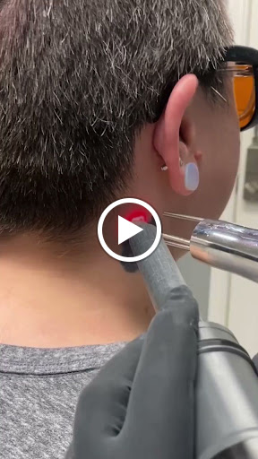 Explore cover up star tattoo ideas, creative tattoo ideas in Denton, available at Denton Laser Tattoo Removal