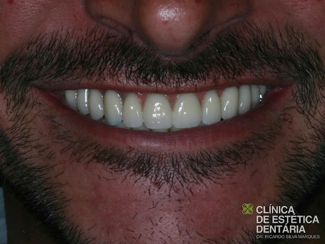 Comentários e avaliações sobre o Clínica de Estética Dentária Dr. Ricardo Silva Marques