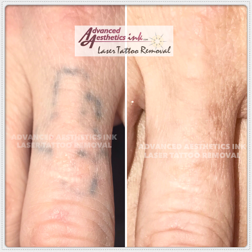 Explore birthstone tattoo ideas, creative tattoo ideas in South Dartmouth, available at Advanced Aesthetics Ink Laser Tattoo Removal