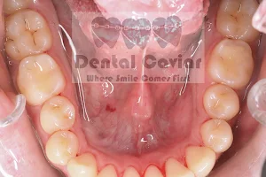 Dental Caviar image