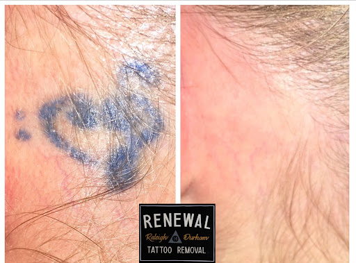 Explore letter g tattoo ideas, creative tattoo ideas in Raleigh, available at Renewal Tattoo Removal