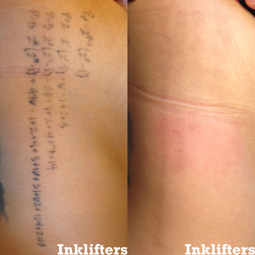 Explore florida gator tattoo ideas, creative tattoo ideas in Pleasant Grove, available at Inklifters Tattoo Removal