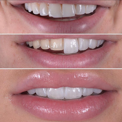Dental Clinique - Diseño de sonrisa - Ortodoncia - Implantes Dentales - Odontologia General - Bichectomía