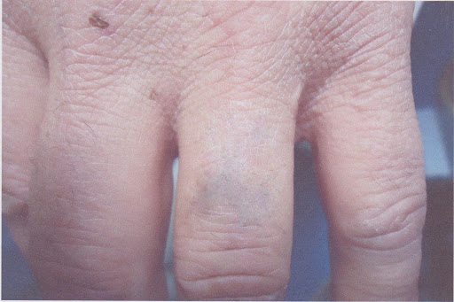 Explore mens upper back tattoo ideas, creative tattoo ideas in Reno, available at Reno Tattoo Removal